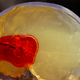 Illustration for article titled Got Blood on the Brain? Shove This Clot Buster Up Your Nose